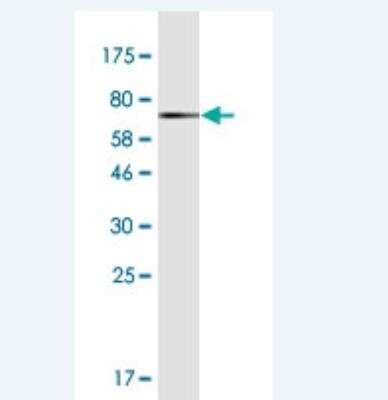 Western Blot: PSMC6 Antibody (1E5) [H00005706-M04]