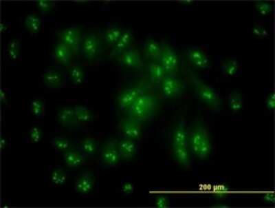 Immunocytochemistry/ Immunofluorescence: PSMC6 Antibody (2C4) [H00005706-M02]