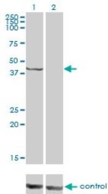 Western Blot: PSMC6 Antibody (2C4) [H00005706-M02]