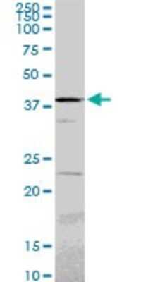 Western Blot: PSMC6 Antibody (2C4) [H00005706-M02]