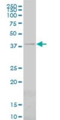 Western Blot: PSMC6 Antibody (2C4) [H00005706-M02]