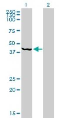 Western Blot: PSMC6 Antibody (2C4) [H00005706-M02]