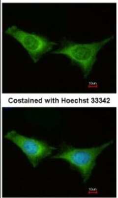 Immunocytochemistry/ Immunofluorescence: PSMC6 Antibody [NBP2-19985]