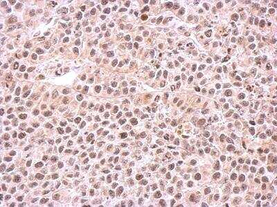 Immunohistochemistry-Paraffin: PSMC6 Antibody [NBP1-32403]