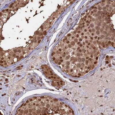 Immunohistochemistry-Paraffin: PSMC6 Antibody [NBP2-13822]