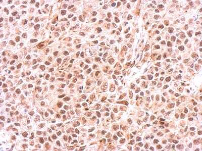 Immunohistochemistry-Paraffin: PSMC6 Antibody [NBP2-19985]