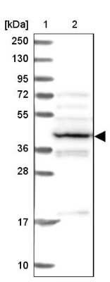 Western Blot: PSMC6 Antibody [NBP2-13822]