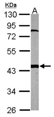 Western Blot: PSMC6 Antibody [NBP2-19985]