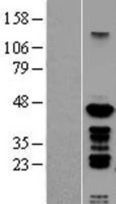 Western Blot: PSMC6 Overexpression Lysate [NBL1-14893]