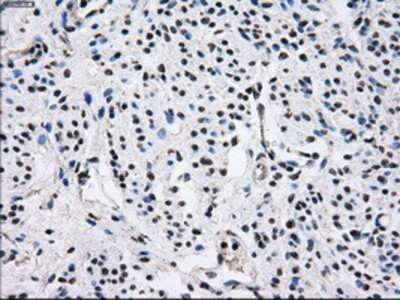 Immunohistochemistry-Paraffin: Gankyrin Antibody (OTI3F6) [NBP2-02199]