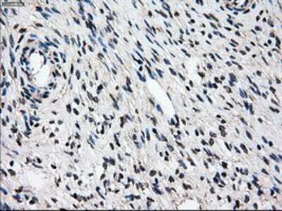 Immunohistochemistry-Paraffin: Gankyrin Antibody (OTI3F6) [NBP2-02199]