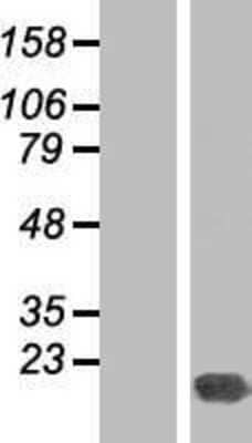 Western Blot: Gankyrin Overexpression Lysate [NBP2-05202]