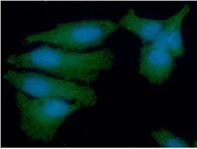 Immunocytochemistry/ Immunofluorescence: PSMD11 Antibody (2C7) - BSA Free [NBP2-59484]