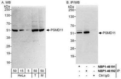 Western Blot: PSMD11 Antibody [NBP1-46191]