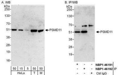 Western Blot: PSMD11 Antibody [NBP1-46192]