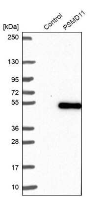 Western Blot: PSMD11 Antibody [NBP1-82700]