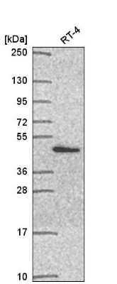 Western Blot: PSMD11 Antibody [NBP2-55793]