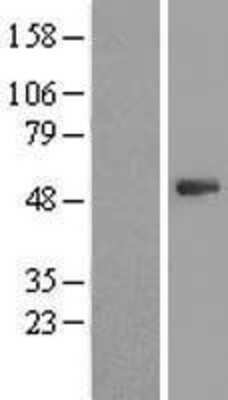 Western Blot: PSMD11 Overexpression Lysate [NBL1-14896]