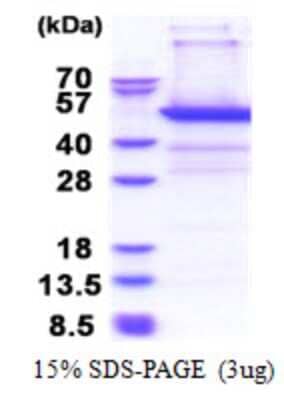 SDS-PAGE: Recombinant Human PSMD11 His Protein [NBP2-23372]