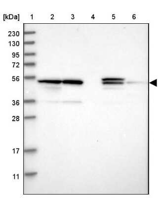 Western Blot: PSMD12 Antibody [NBP1-87801]