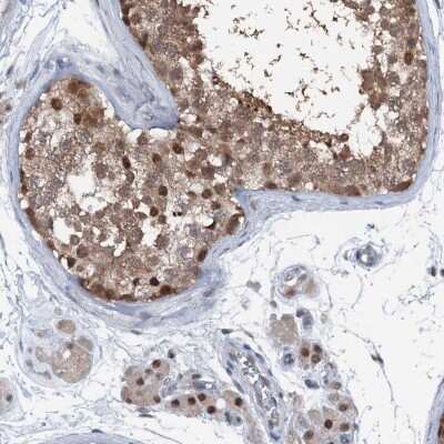 Immunohistochemistry-Paraffin: PSMD13 Antibody [NBP2-38426]