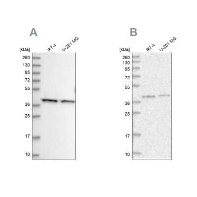 Western Blot: PSMD13 Antibody [NBP2-38426]