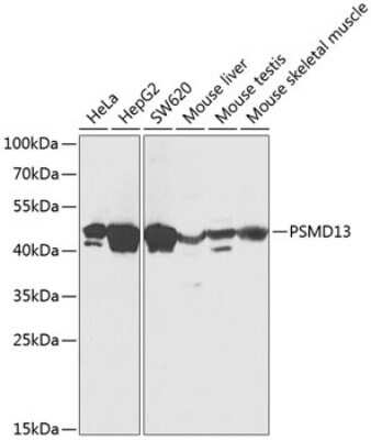 Western Blot: PSMD13 AntibodyBSA Free [NBP2-94121]