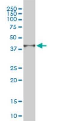 Western Blot: PSMD14 Antibody (4A10-E8) [H00010213-M01]