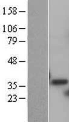 Western Blot: PSMD14 Overexpression Lysate [NBL1-14899]