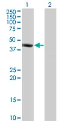 Western Blot: PSMD6 Antibody (1C1) [H00009861-M01]