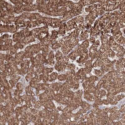 Immunohistochemistry: PSMD6 Antibody [NBP2-32677]