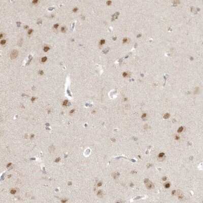 Immunohistochemistry-Paraffin: PSMD6 Antibody [NBP1-81545]
