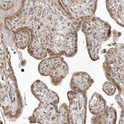 Immunohistochemistry-Paraffin: PSMD6 Antibody [NBP1-81545]