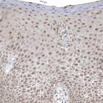 Immunohistochemistry-Paraffin: PSMD6 Antibody [NBP1-81545]