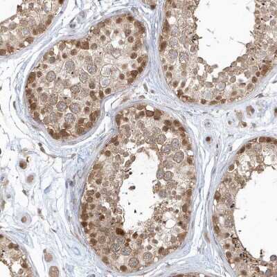 Immunohistochemistry-Paraffin: PSMD6 Antibody [NBP1-81545]