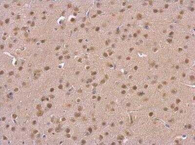 Immunohistochemistry-Paraffin: PSMD6 Antibody [NBP2-19987]