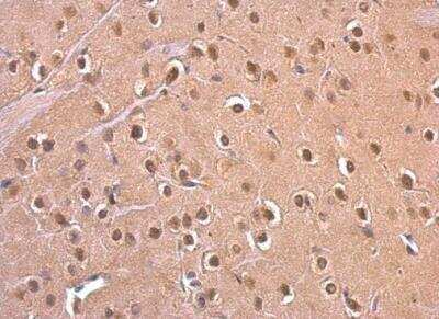 Immunohistochemistry-Paraffin: PSMD6 Antibody [NBP2-19987]