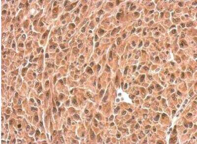 Immunohistochemistry-Paraffin: PSMD6 Antibody [NBP2-19987]