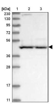 Western Blot: PSMD6 Antibody [NBP1-81545]