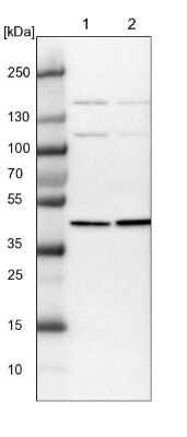 Western Blot: PSMD6 Antibody [NBP1-81545]