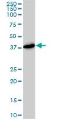 Western Blot: PSMD7 Antibody (2G5) [H00005713-M01]