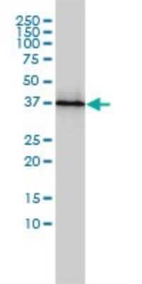 Western Blot: PSMD7 Antibody (2G5) [H00005713-M01]