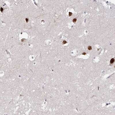 Immunohistochemistry: PSMD7 Antibody [NBP2-38612]