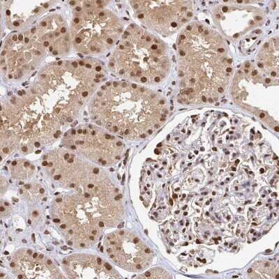 Immunohistochemistry: PSMD7 Antibody [NBP2-38780]
