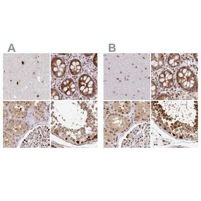 Immunohistochemistry-Paraffin: PSMD7 Antibody [NBP2-38612]