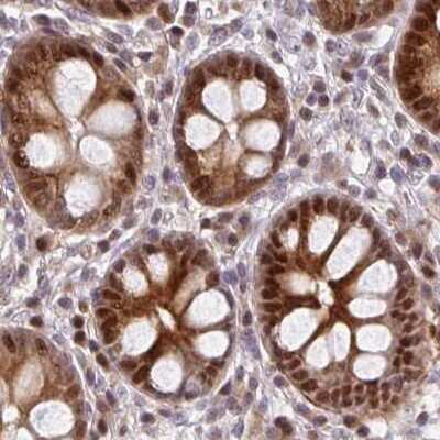 Immunohistochemistry-Paraffin: PSMD7 Antibody [NBP2-38612]