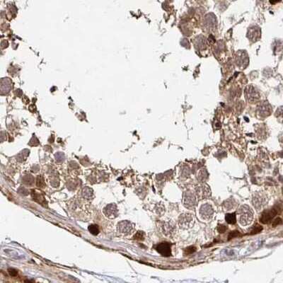 Immunohistochemistry-Paraffin: PSMD7 Antibody [NBP2-38612]