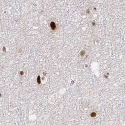 Immunohistochemistry-Paraffin: PSMD7 Antibody [NBP2-38612]