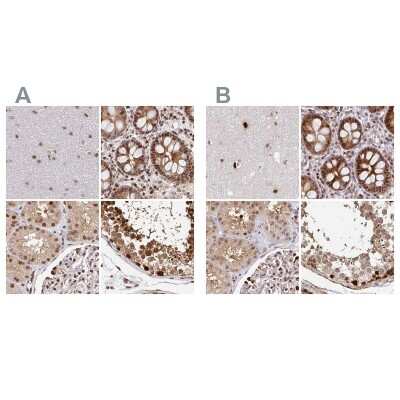 Immunohistochemistry-Paraffin: PSMD7 Antibody [NBP2-38780]