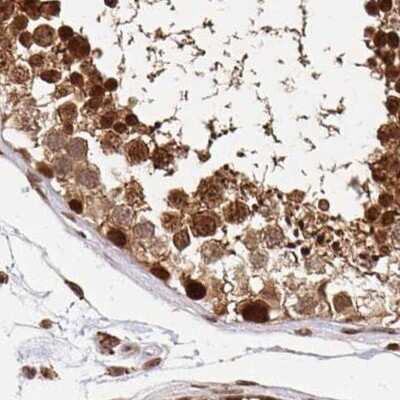 Immunohistochemistry-Paraffin: PSMD7 Antibody [NBP2-38780]